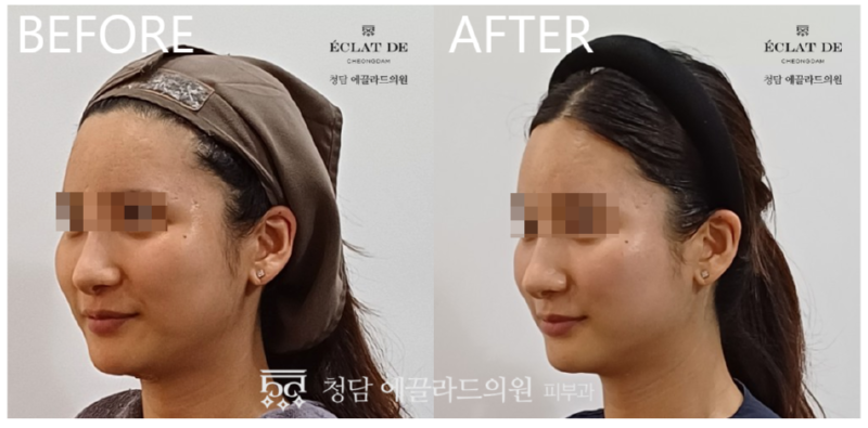 스크린샷_2026-01-02_173913.png