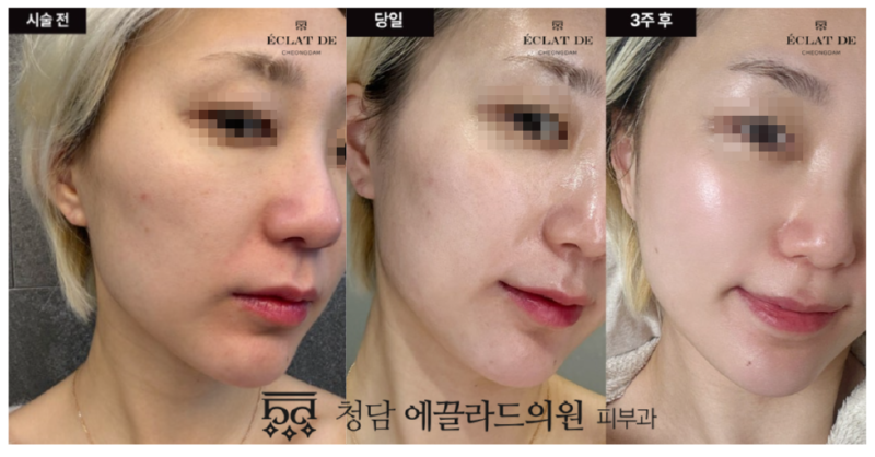 스크린샷_2025-08-12_114850.png