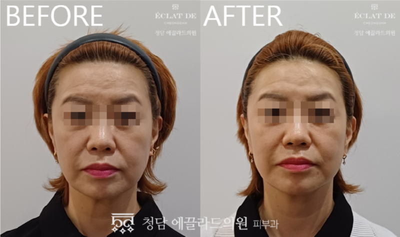 스크린샷_2026-03-25_154324.png