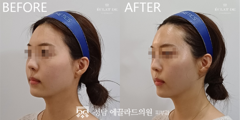 스크린샷_2026-03-25_140059.png