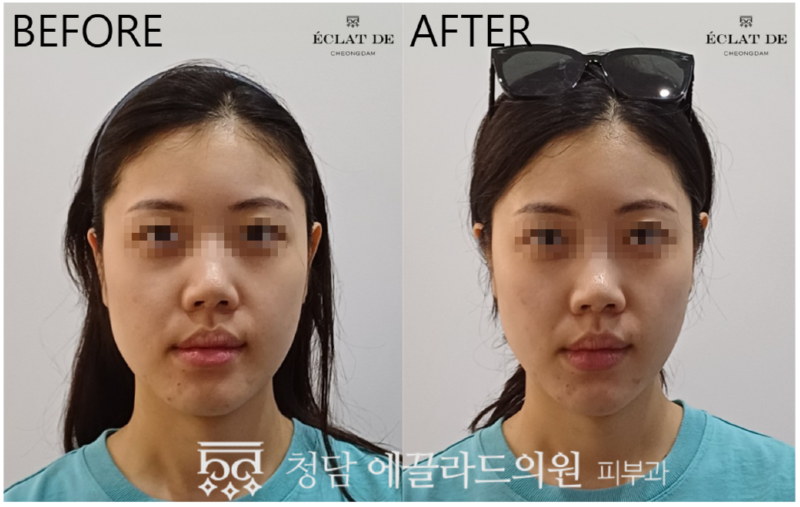 스크린샷_2025-08-12_112238.png
