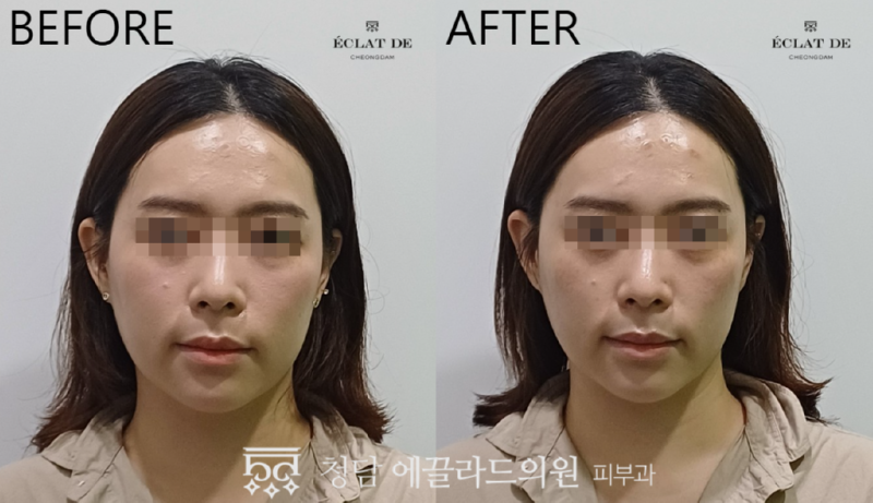 스크린샷_2026-01-15_114430.png
