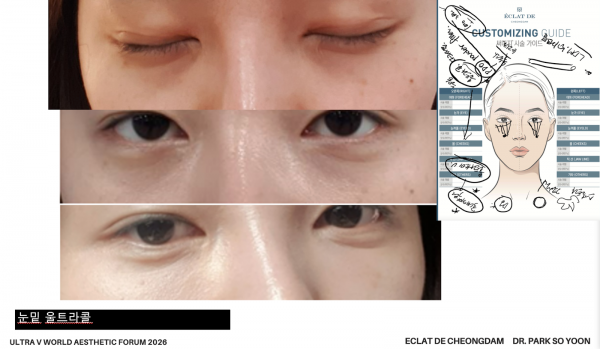 thumb-3547142071_1769153673.0641_600x349.png