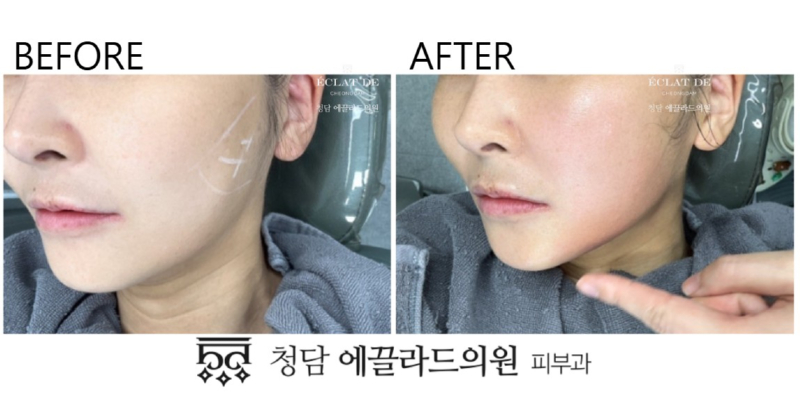 화면 캡처 2026-04-16 151131.jpg