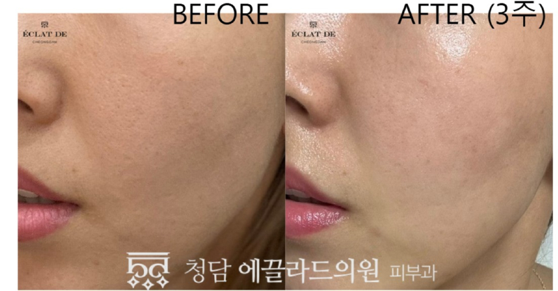 화면 캡처 2026-04-16 164249.jpg
