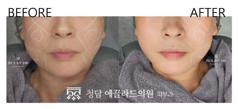 화면 캡처 2026-04-16 151312.jpg