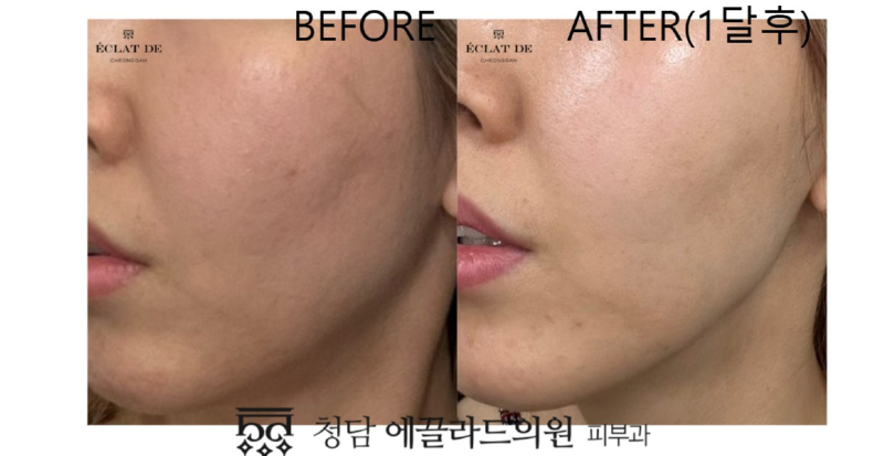 화면 캡처 2026-04-16 165313.jpg