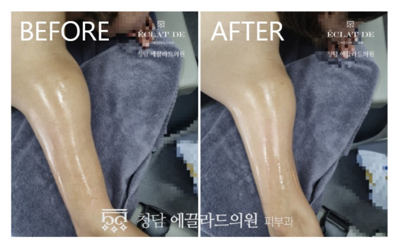 화면 캡처 2026-04-16 153144.jpg