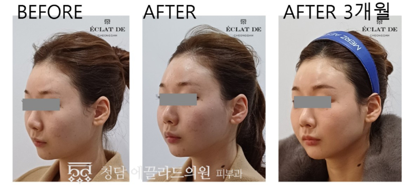 화면 캡처 2026-04-17 173529.jpg