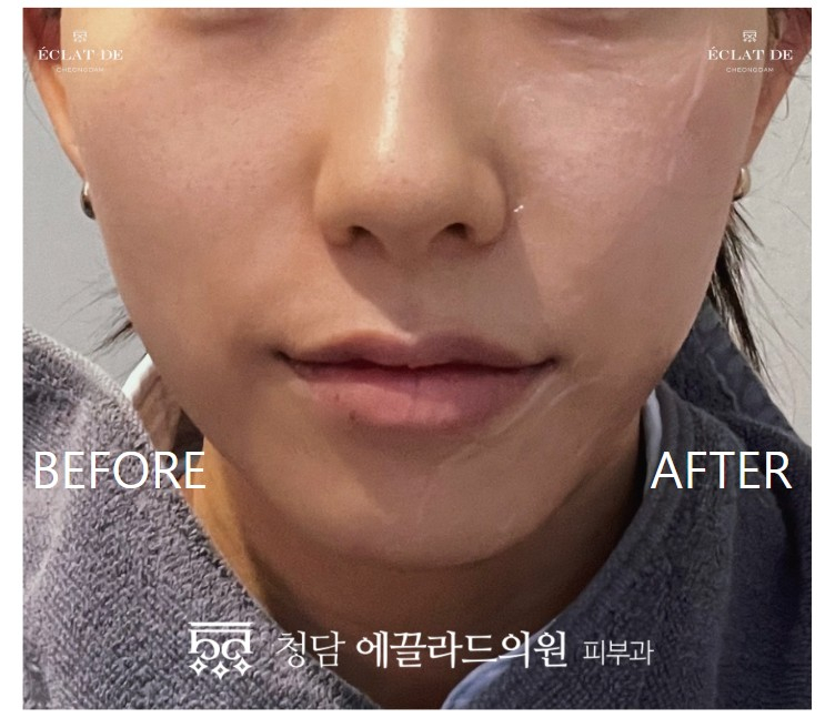 화면 캡처 2026-04-17 182757.jpg