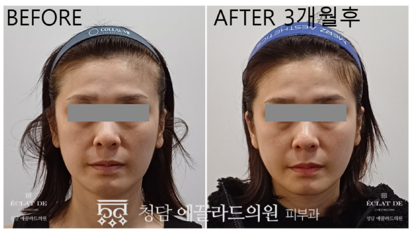 화면 캡처 2026-04-17 140010.jpg