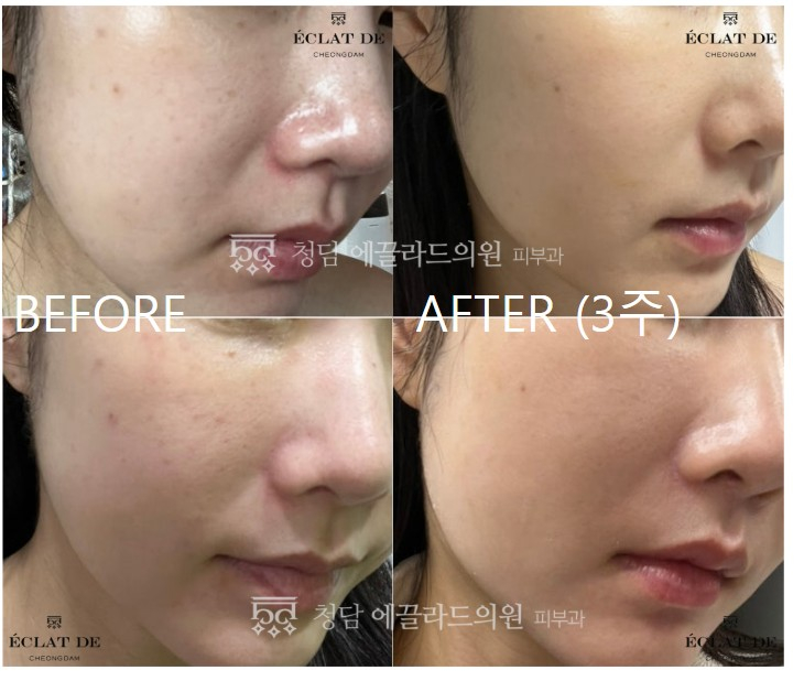 화면 캡처 2026-04-17 140757.jpg