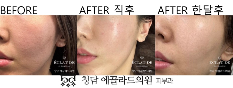 화면 캡처 2026-04-17 172017.jpg