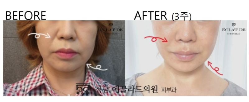 화면 캡처 2026-04-17 135929.jpg