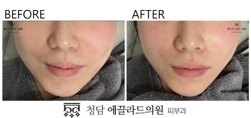 화면 캡처 2026-04-17 143256.jpg