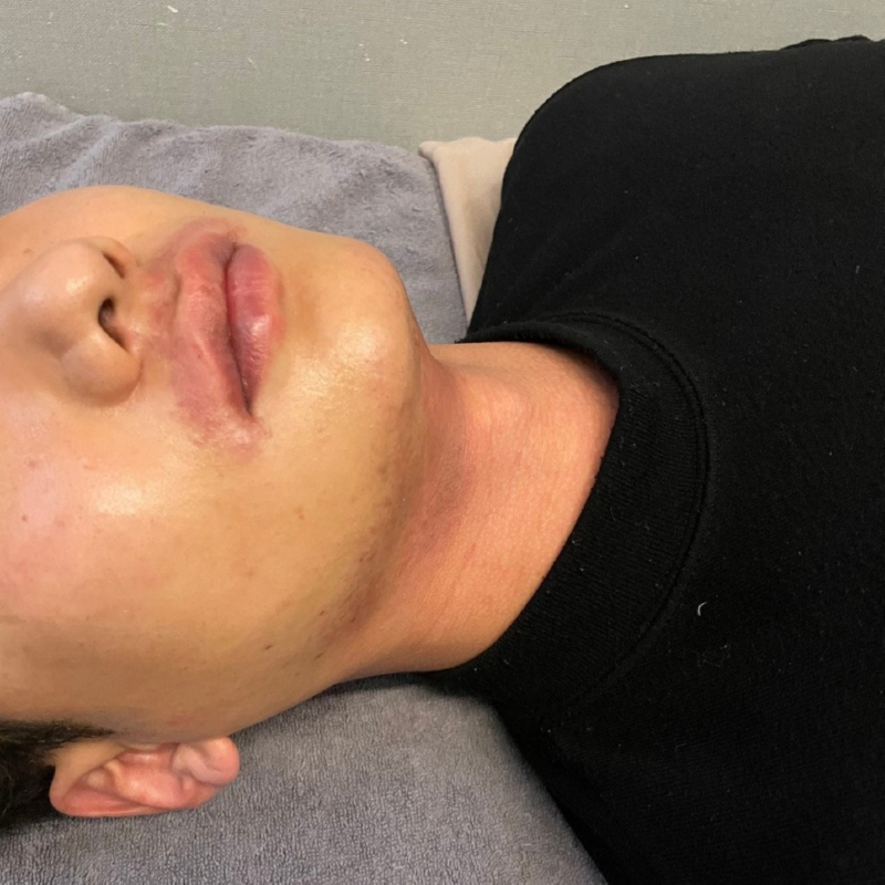 남자수염제모_(15).jpg