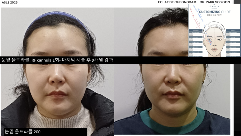 슬라이드22.PNG.png