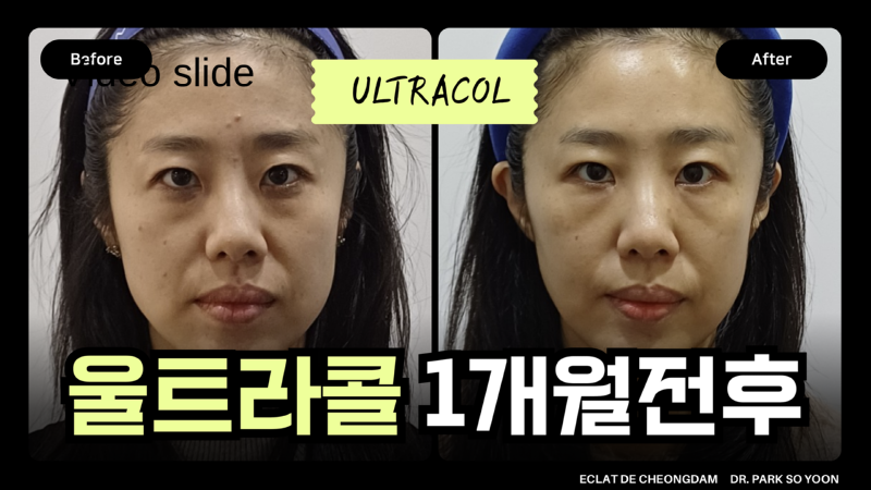 슬라이드24.PNG.png